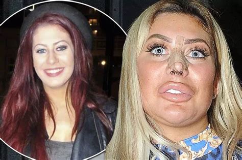 chloe ferry surgery|chloe cherry before plastic surgery.